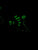 MELVINS: ELECTRORETARD LP Reissue *Glow in the Dark Lobotomy Edition*